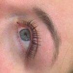Botox